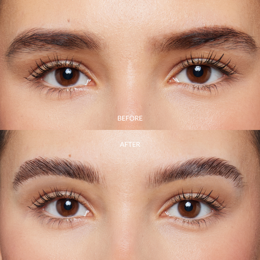 Browlift Kit – Nueva Generación
