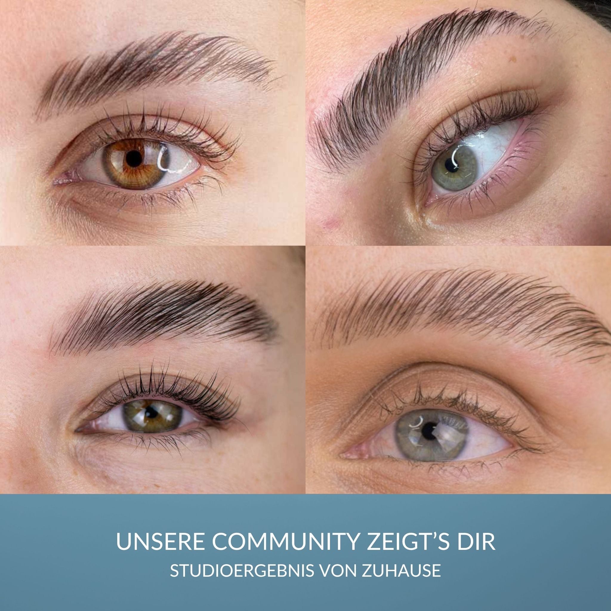 Browlift Kit – Nuova Generazione