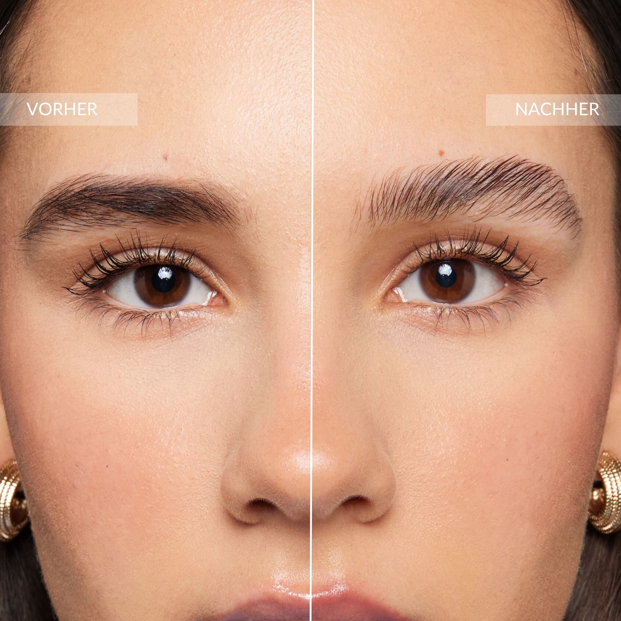 Browlift Kit - New Generation