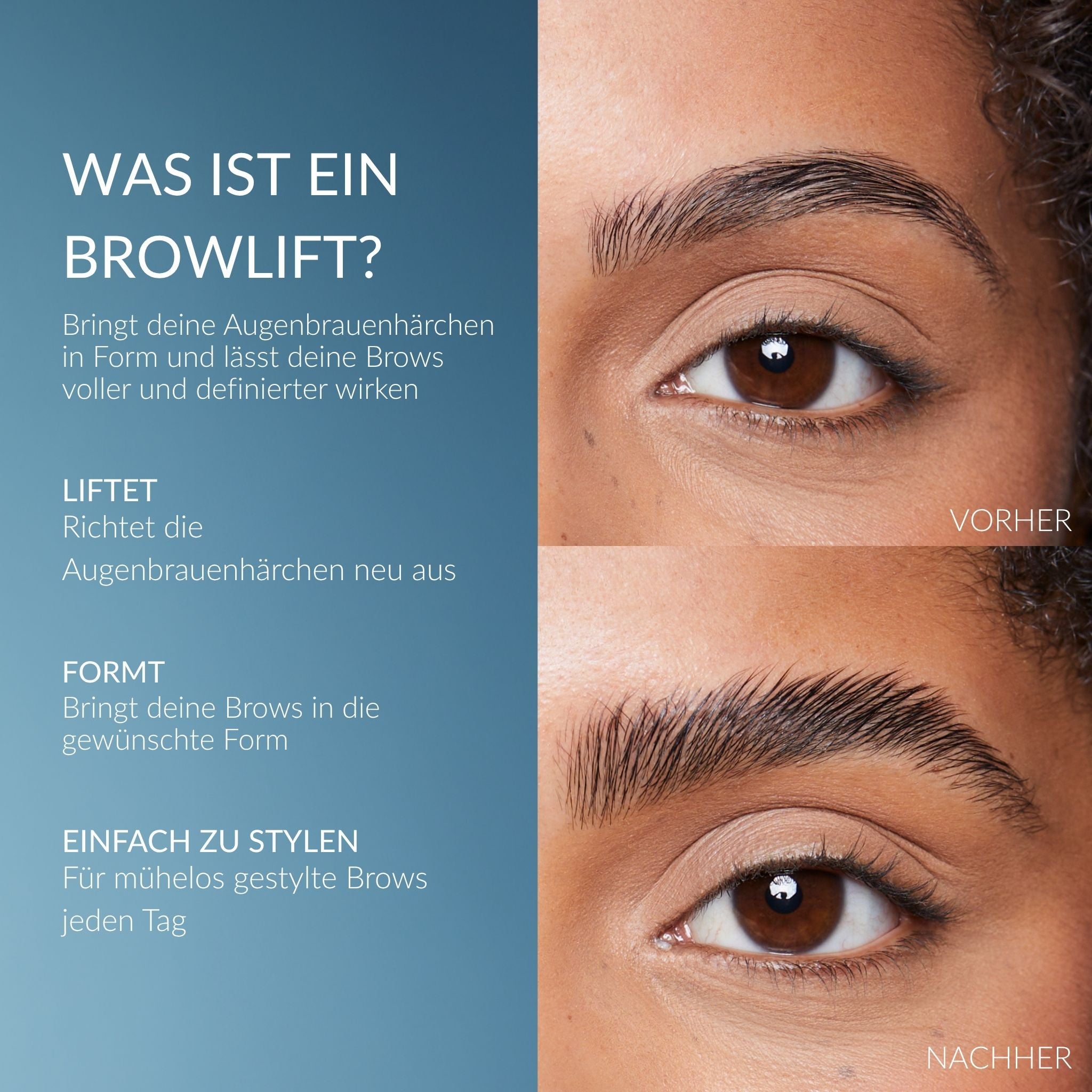 Browlift Kit – Nuova Generazione