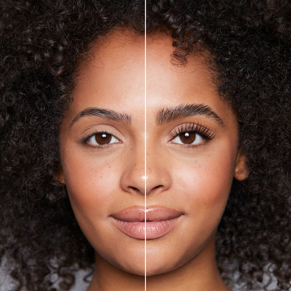 Brow Lift vorher nachher Brow Lift vorher nachher